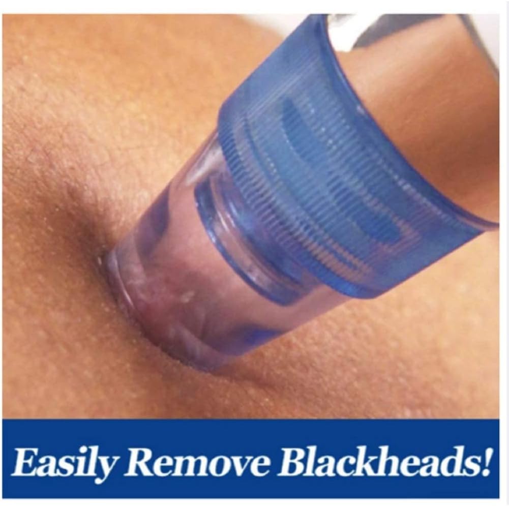 Black Head Remover